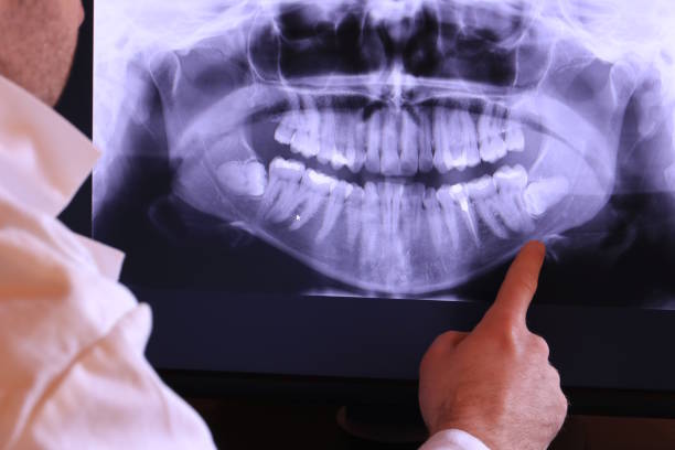 Trusted NM Emergency Dentist Experts